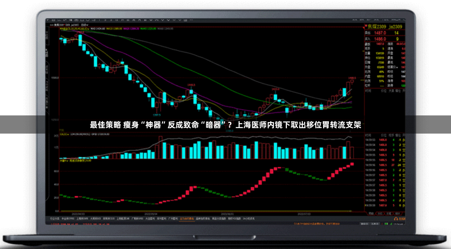 最佳策略 瘦身“神器”反成致命“暗器”?上海医师内镜下取出移位胃转流支架